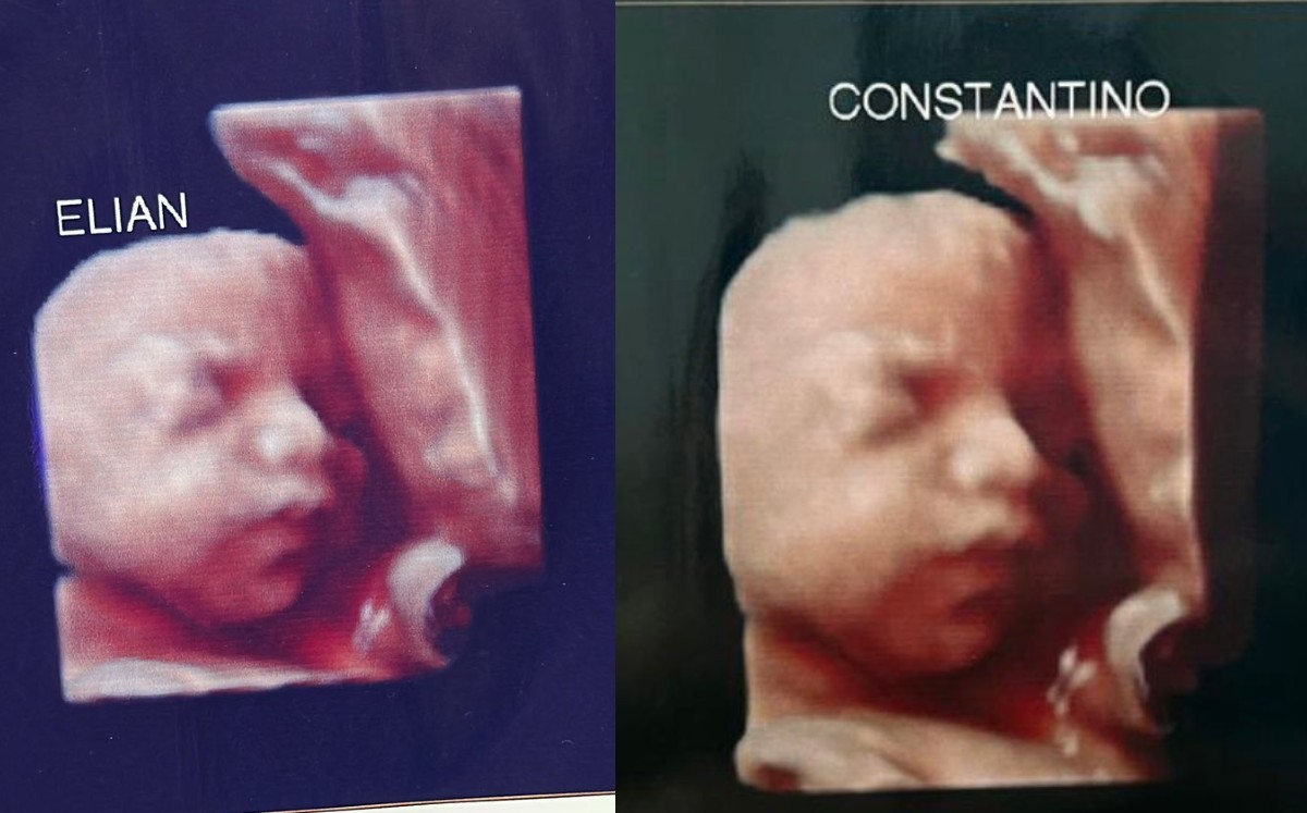 Denuncian a clínica por usar misma foto en ultrasonidos en Argentina