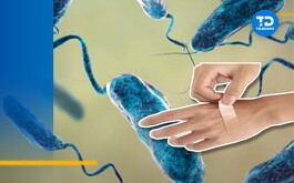 Cómo se contagia de la bacteria come carne