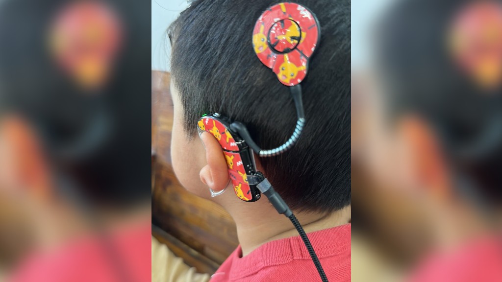 Madre pide ayuda para localizar procesador de implante coclear / Cortesía Facebook