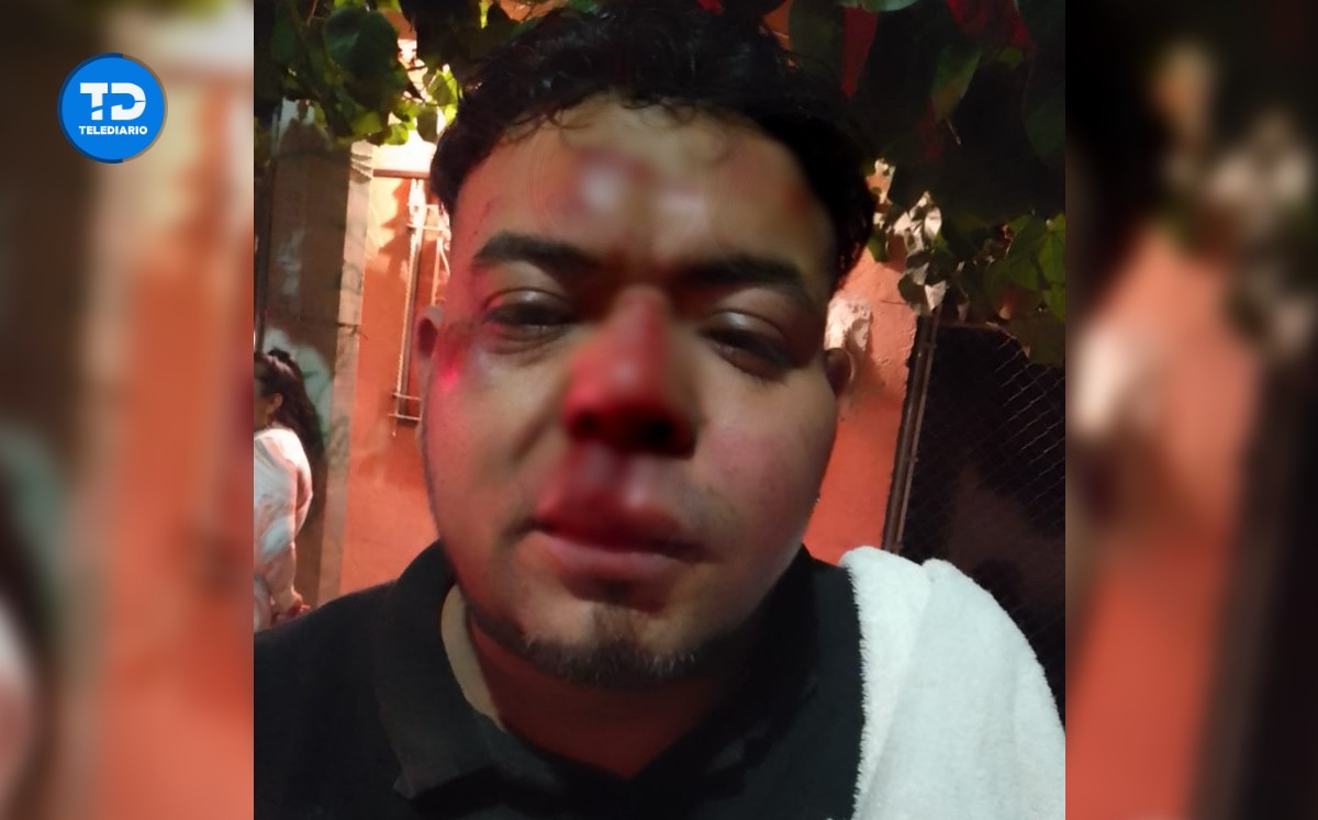 Músico fue agredido por asistentes del baile | Cortesía
