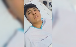 Cristian se encuentra en el hospital con quemaduras de segundo y tercer grado, luego de que fuera quemado por sus propios compañeros al interior del CEDVA