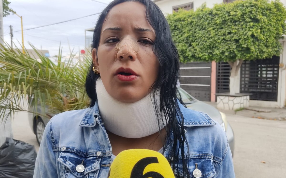 Torreón, mujer golpeada