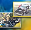 La unidad de carga pesada invadió el carril contrario, por lo que el conductor del auto resultó lesionado tras el percance.