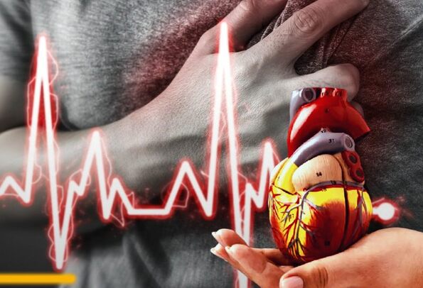 imagen ilustrativa de un corazón y una persona teniendo un infarto imagen ilustrativa de un corazón y una persona teniendo un infarto