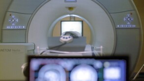 Un hombre de 61 años murió al ser succionado por un escáner de resonancia magnética en Nueva York, tras entrar con una cadena metálica al cuello.
