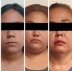 Dos cateos se realizaron de manera simultanea en colonias de Monterrey, dejando un saldo de cinco mujeres detenidas con armas y drogas.