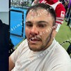Buscan imputar a Lord Pádel por tentativa de homicidio tras golpiza contra entrenador en Atizapán