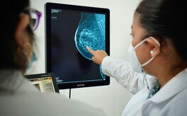 Los tumores de cáncer de mama son una de las enfermedades con mayor incidencia y mortalidad en el mundo.