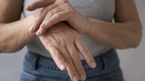 artritis reumatoide aún causa discapacidad