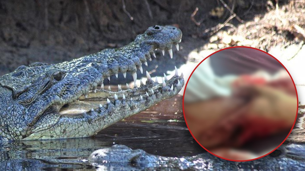 Salvavidas atendieron al turista y luego lo trasladaron al Hospital General de San Pedro Pochutla, dado que una de sus piernas podía desprenderse.