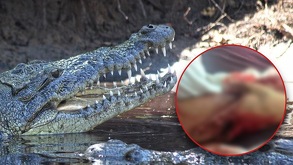Salvavidas atendieron al turista y luego lo trasladaron al Hospital General de San Pedro Pochutla, dado que una de sus piernas podía desprenderse.