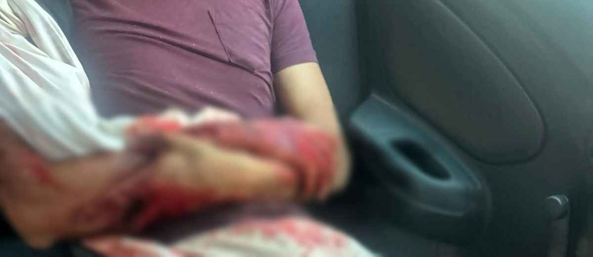 Salvavidas atendieron al turista y luego lo trasladaron al Hospital General de San Pedro Pochutla, dado que una de sus piernas podía desprenderse. Salvavidas atendieron al turista y luego lo trasladaron al Hospital General de San Pedro Pochutla, dado que una de sus piernas podía desprenderse.