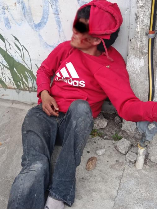 La mujer salía de una panadería cuando fue abordada por su agresor, con quien forcejeó para evitar ser asaltada para luego ser auxiliada por vecinos.
