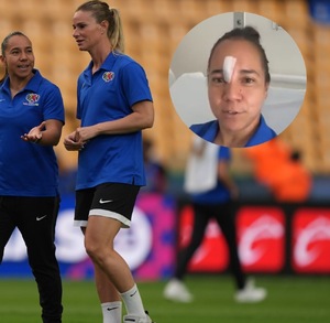 Corral sufrió de una patada en la cara por parte de 'Mapi' León, jugadora del Barcelona femenil durante el partido amistoso ante las futbolistas de la Liga MX.