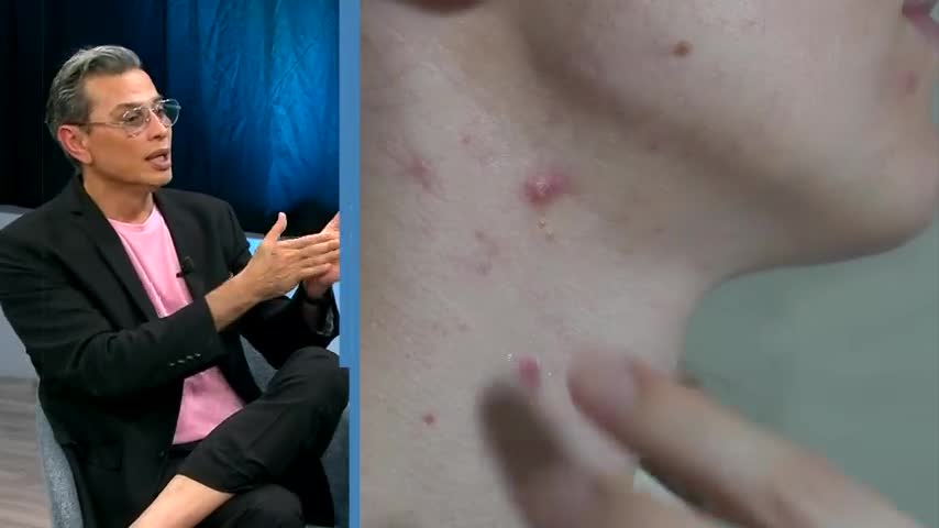 El dermatólogo Julio César Salas recordó que este problema se agudizó debido a las plataformas como Instagram, TikTok e incluso ChatGPT.
