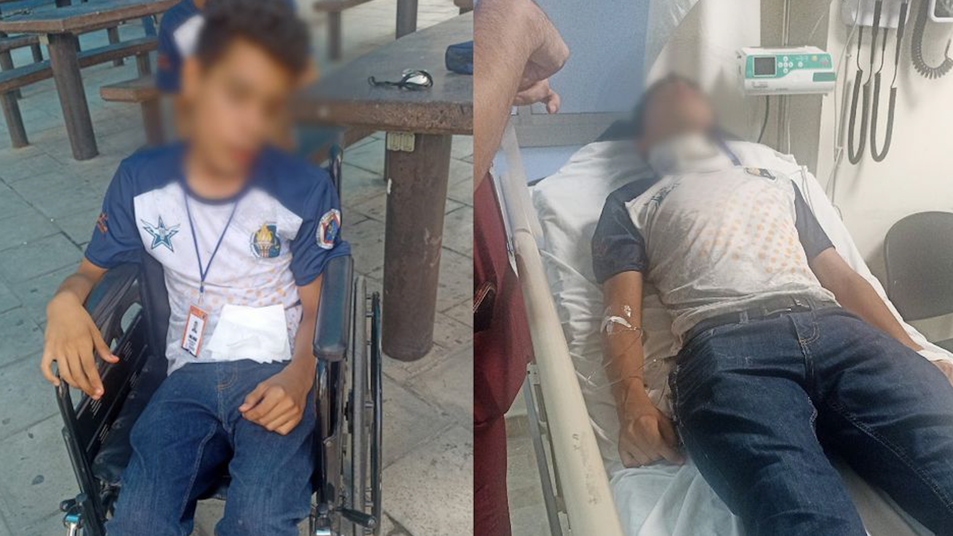 La mamá del estudiante aseguró que su hijo fue golpeado con un banco durante clases y no fue atendido inmediatamente.