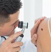 Lunares y el cáncer de piel Lunares y el cáncer de piel