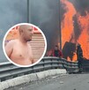 Juan Carlos Bonilla Sánchez, otra de las víctimas de explosión en Iztapalapa; se viralizó en redes con sus quemaduras.