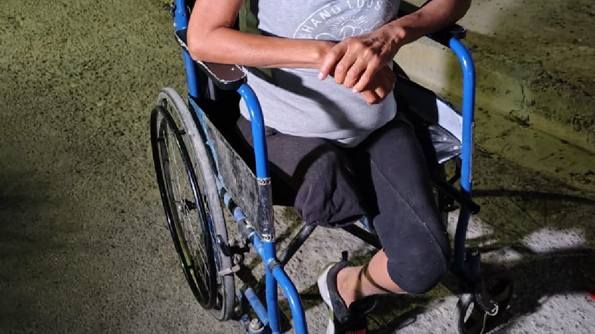 Aracely Montelongo Gutiérrez, una mujer de 50 años que perdió una pierna busca el apoyo de la comunidad lagunera para conseguir una prótesis.