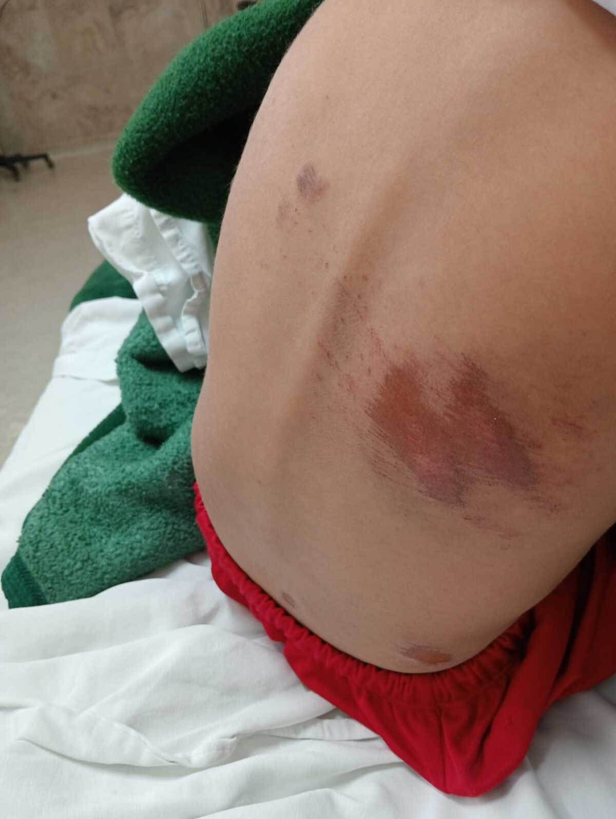 Fernando, un niño de tan solo cinco años de edad, fue brutalmente atropellado por el conductor de un vehículo de alquiler en Torreón.