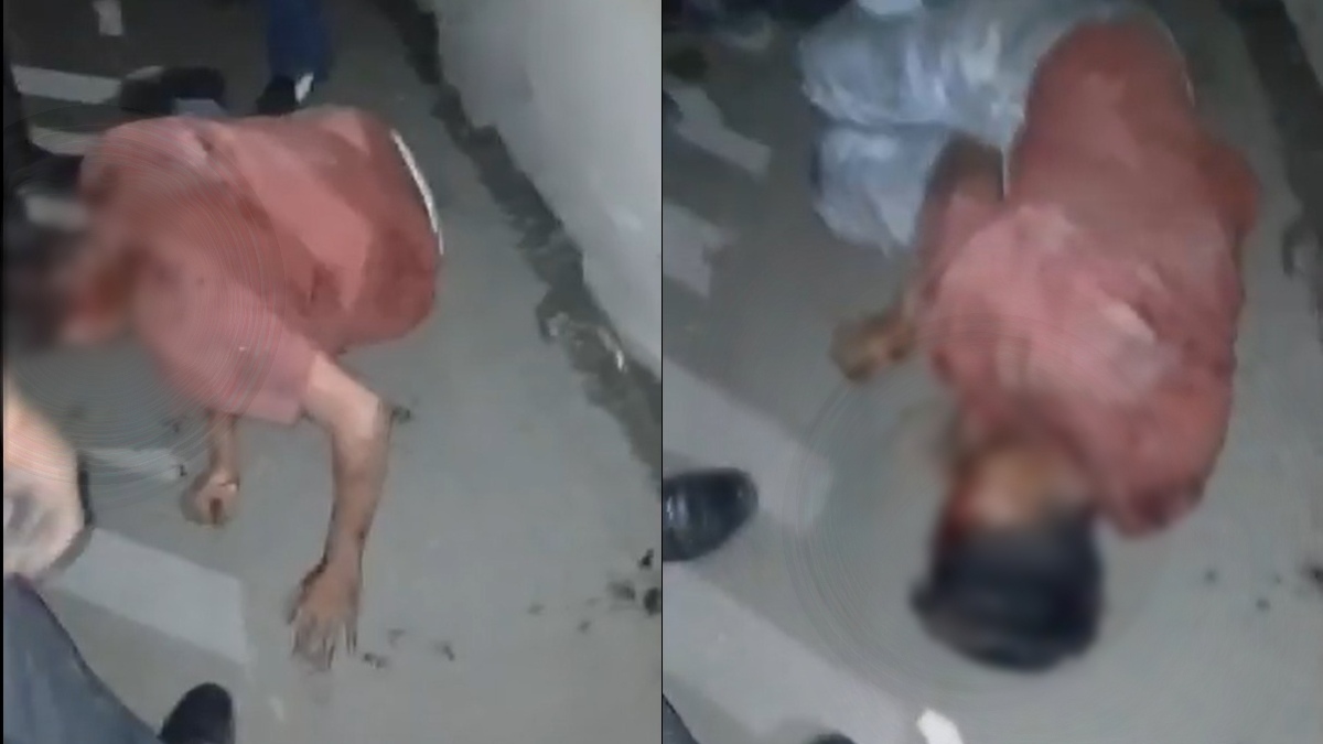 un hombre golpeado