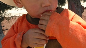 El virus Coxsackie también es conocido como la enfermedad de manos, pies y boca, cuyos síntomas pueden incluir fiebre, llagas en la boca y erupciones.