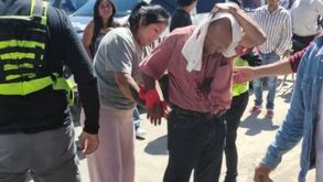 Hombre se sujeta la cabeza por una herida en el municipio de Coronango, Puebla.