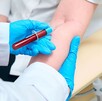 Detección de cáncer de sangre Detección de cáncer de sangre
