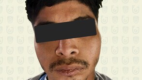 Imagen de Eddy, joven de 24 años que fue detenido por presuntamente quemar viva a una mujer en la alcaldía Gustavo A. Madero de la Ciudad de México.