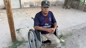 Álvaro Sifuentes, hombre que pide apoyo para conseguir una prótesis tras perder una pierna en un accidente de trabajo.