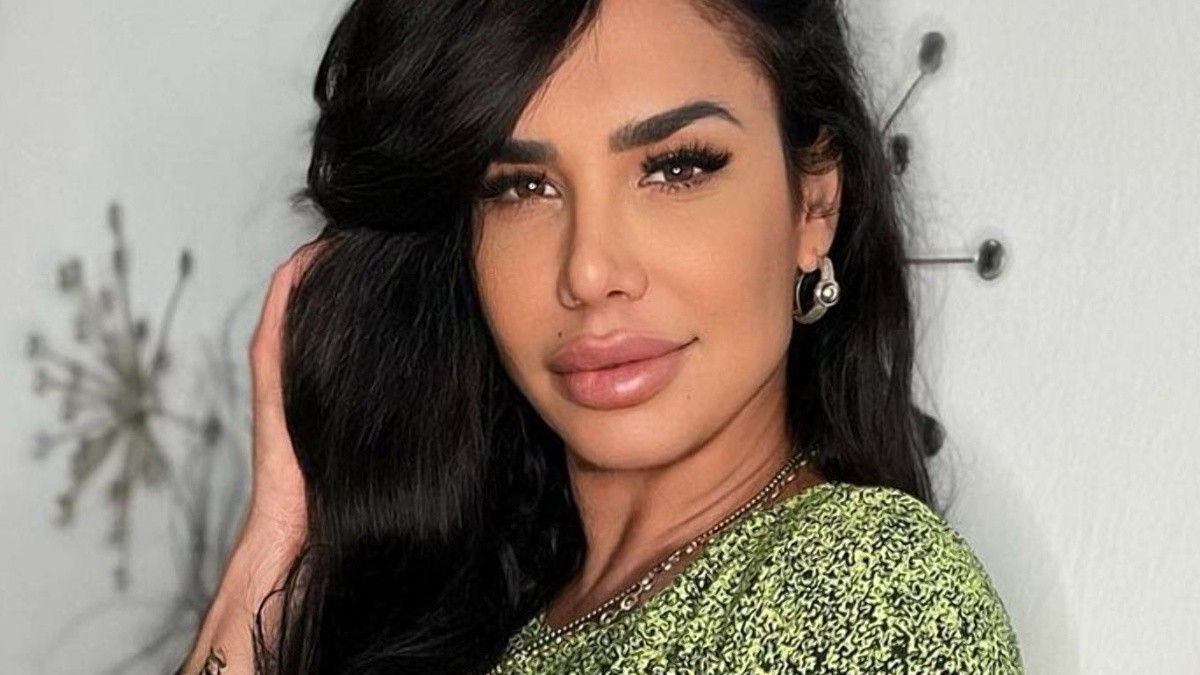 La atención mediática hacia la vedette cubana, Lis Vega, se ha centrado constantemente en la notable evolución de su imagen tras sus cirugías. La atención mediática hacia la vedette cubana, Lis Vega, se ha centrado constantemente en la notable evolución de su imagen tras sus cirugías.