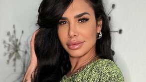 La atención mediática hacia la vedette cubana, Lis Vega, se ha centrado constantemente en la notable evolución de su imagen tras sus cirugías.