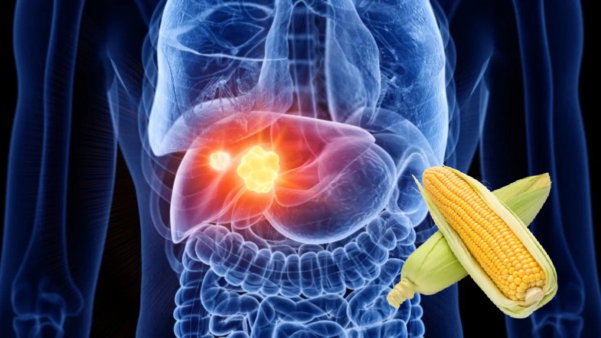 Ilustración médica: se ve el hígado dentro de la silueta del cuerpo, mostrando un tumor iluminado. Un par de elotes o choclos (maíz) se superponen a la imagen Ilustración médica: se ve el hígado dentro de la silueta del cuerpo, mostrando un tumor iluminado. Un par de elotes o choclos (maíz) se superponen a la imagen