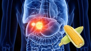 Ilustración médica: se ve el hígado dentro de la silueta del cuerpo, mostrando un tumor iluminado. Un par de elotes o choclos (maíz) se superponen a la imagen