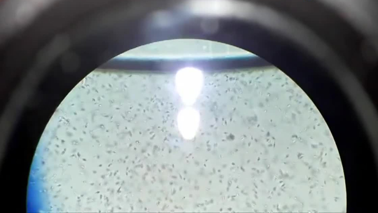 Investigadores de la Universidad de Columbia lograron el primer embarazo mediante un sistema automatizado guiado por Inteligencia Artificial.