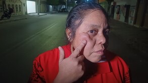 María Isabel, mujer que fue atacada por un indigente en la calzada Colón de Torreón.