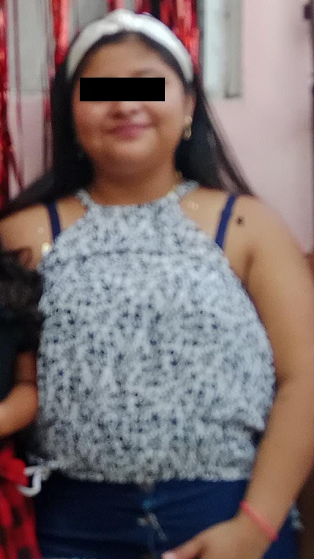 Mujer joven con una cinta negra sobre los ojos mirando hacia la cámara.