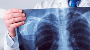 foto genérica de un doctor sosteniendo una radiografía.