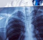 foto genérica de un doctor sosteniendo una radiografía.