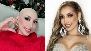 Raquel Escalante antes y despues de su enfermedad.