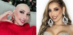 Raquel Escalante antes y despues de su enfermedad.