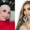 Raquel Escalante antes y despues de su enfermedad.