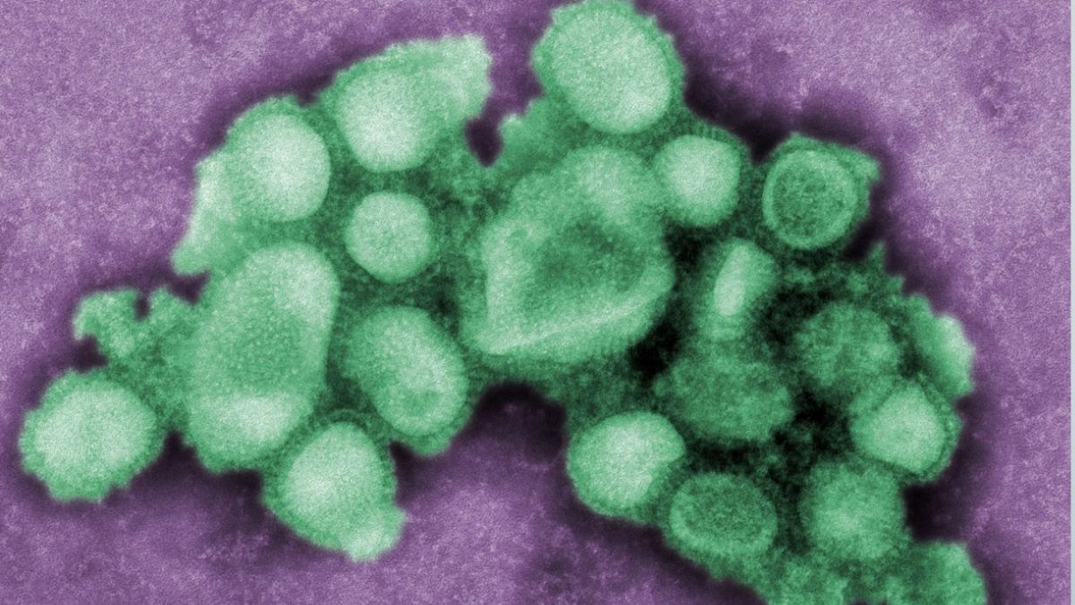 Representación del virus H3N2, una variante de la influenza.
