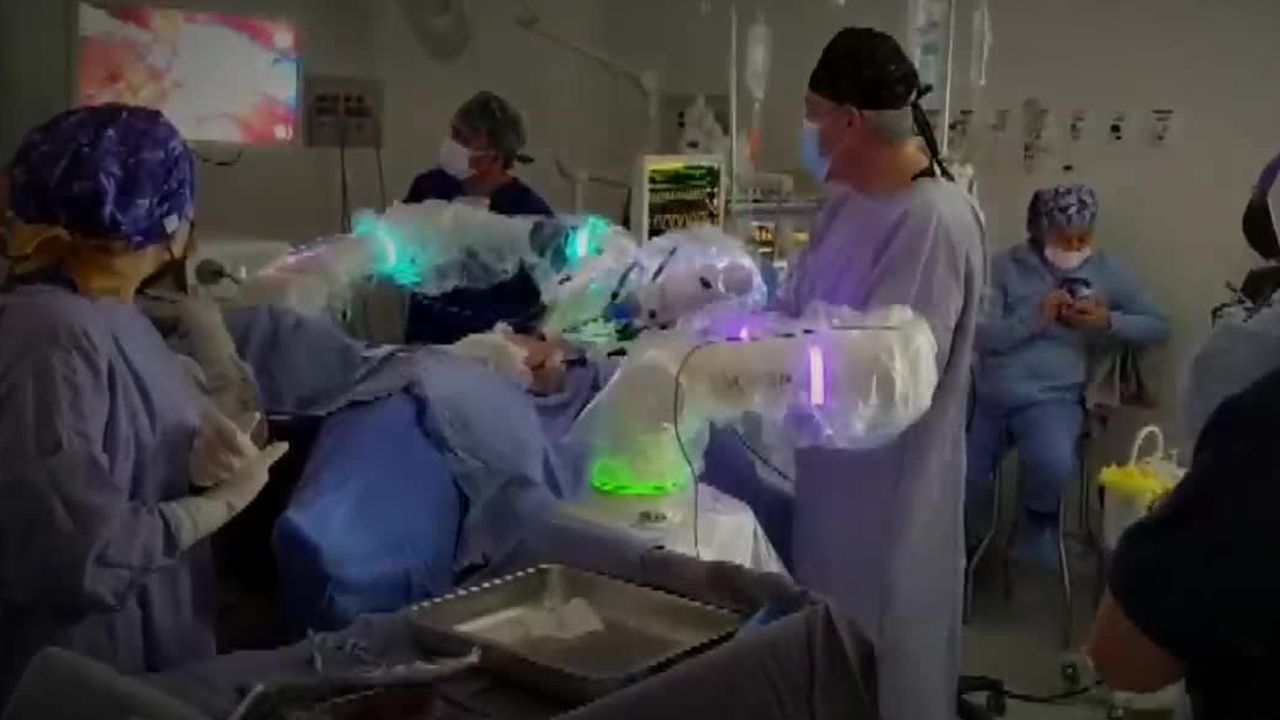 El Estado de México se convirtió en la primera entidad del país en integrar el sistema robótico Versius a su red pública de salud.