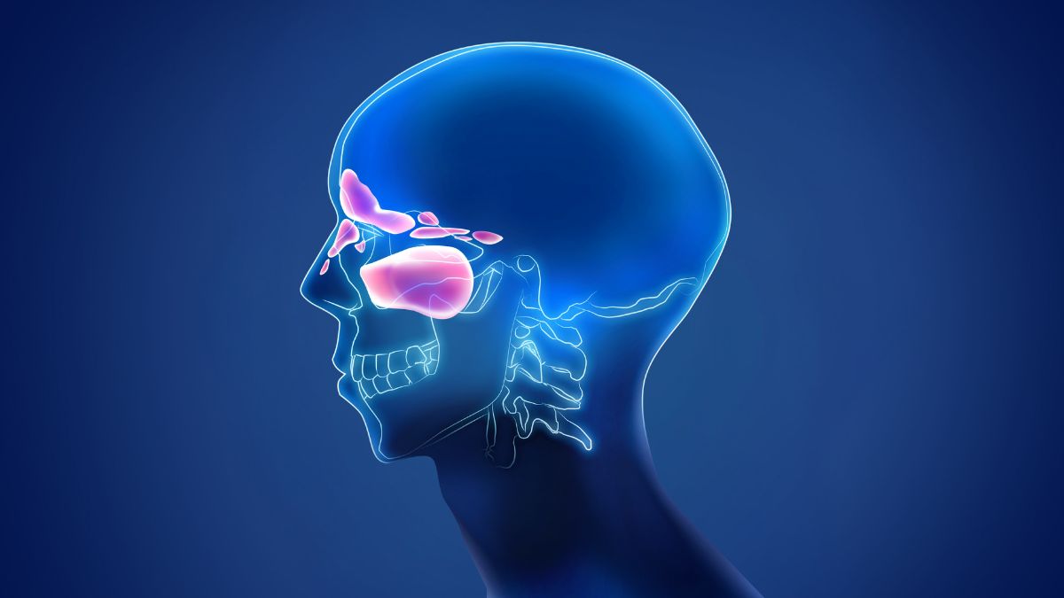 imagen sobre sinusitis