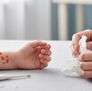 Primer plano de un brazo de niño con sarpullido rojo (simulando sarampión o varicela). Un termómetro está cerca y manos adultas sostienen un pañuelo de papel en