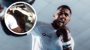 Anthony Joshua fue captado aturdido y sin playera tras el accidente.