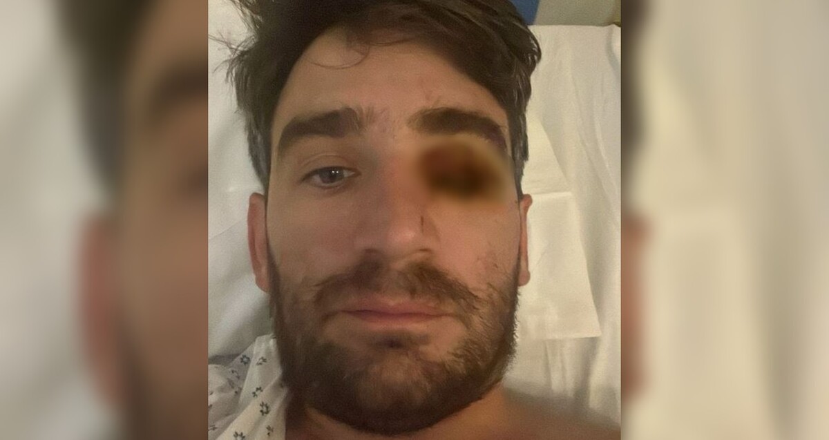 Hombre identificado como Ignacio Leiva viendo de frente con uno de los ojos herido y censurado mientras está en la cama de un hospital