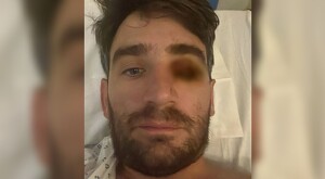 Hombre identificado como Ignacio Leiva viendo de frente con uno de los ojos herido y censurado mientras está en la cama de un hospital
