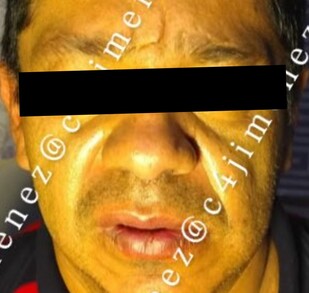 Detienen a 'El Escorpión', presunto líder de El Cártel de Tláhuac, en CdMx; estuvo tras las rejas en 2022.